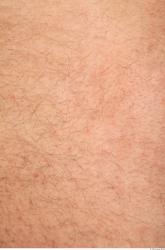 Photo Textures of Human Skin